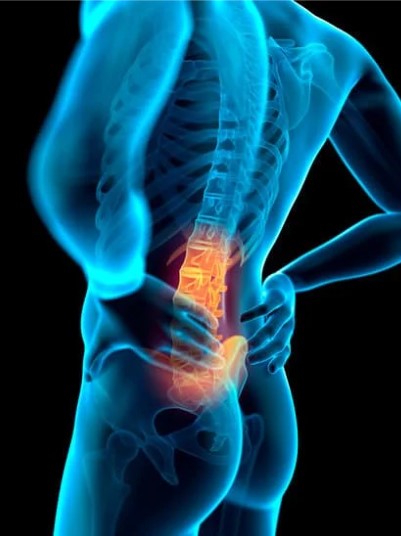 Dolor Lumbar crónico
