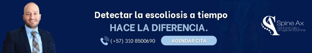 Escoliosis Idiopática- Especialistas en cirugía de columna-SpineAx