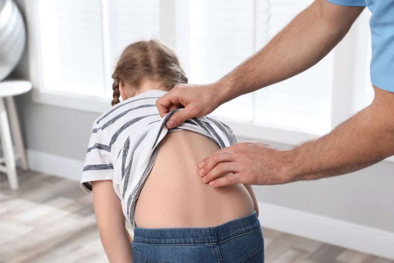 Escoliosis Idiopática- Especialistas en cirugía de columna-SpineAx