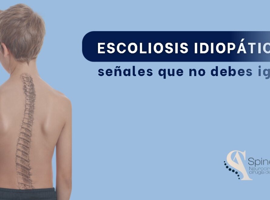 Escoliosis Idiopática- Especialistas en cirugía de columna-SpineAx