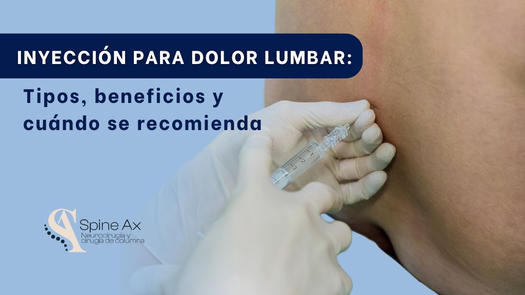 Inyección para dolor lumbar en Bogotá - Spineax - Centro diagnóstico de columna en Bogotá - Colombia