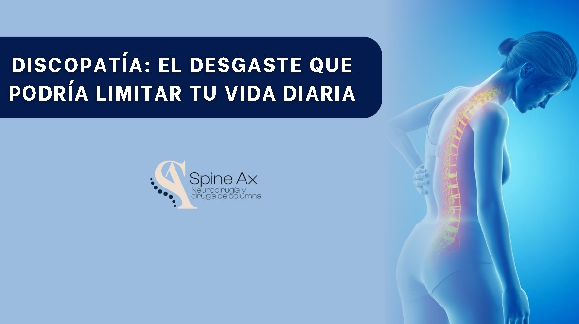 Discopatía- SpineAx