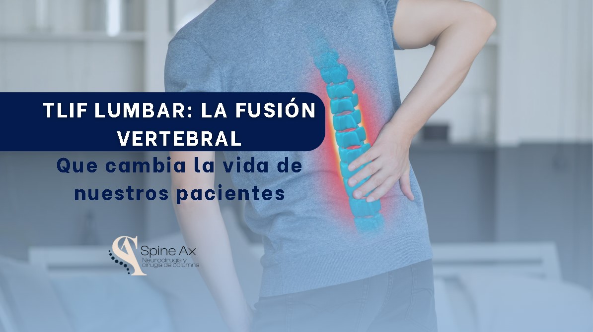 Tlif lumbar-SpineAX