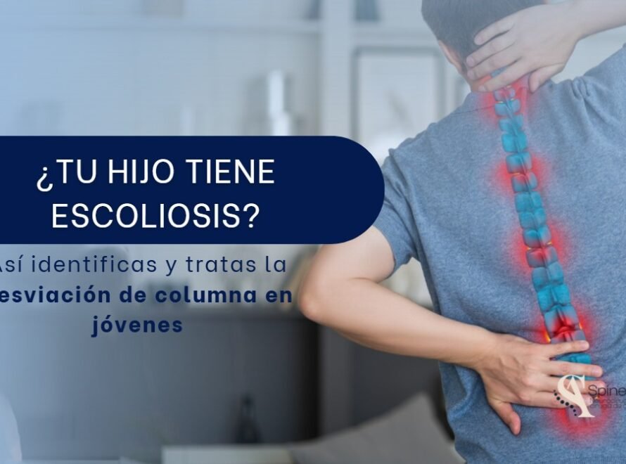Desviación de columna en jóvenes-SpineAx