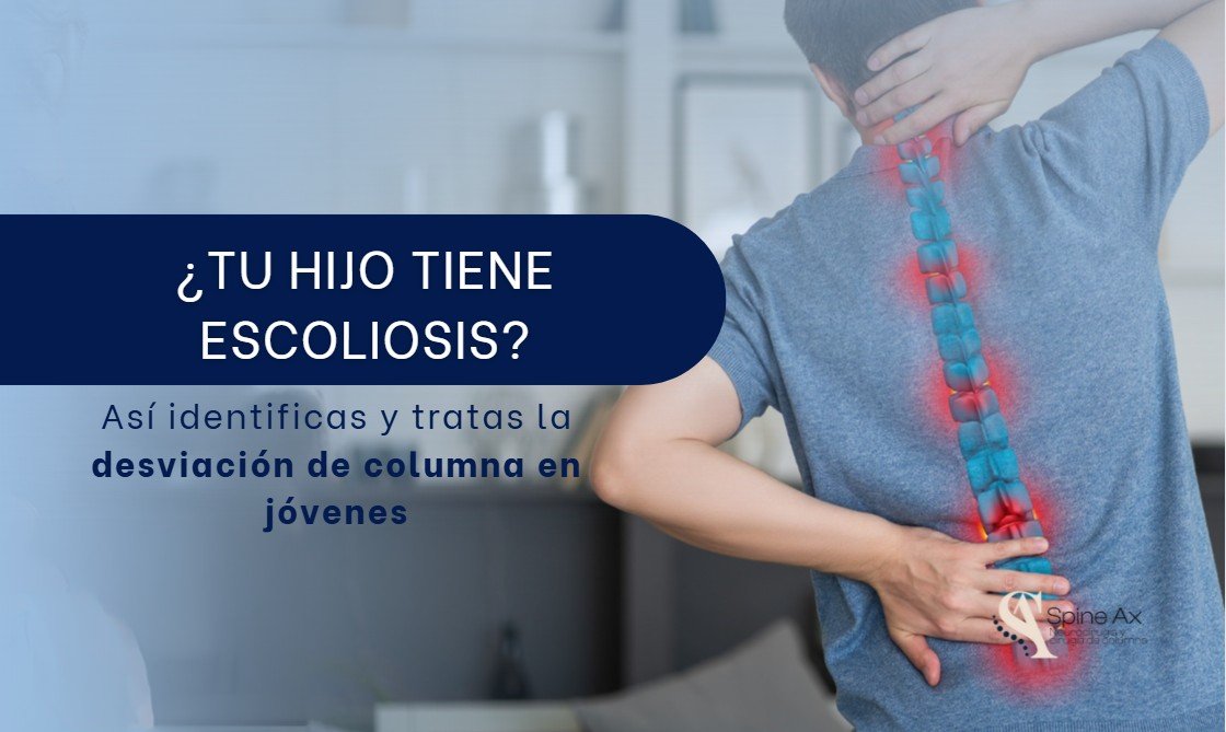 Desviación de columna en jóvenes-SpineAx