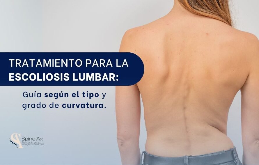 Tratamiento para la escoliosis lumbar en Bogotá - Spine AX