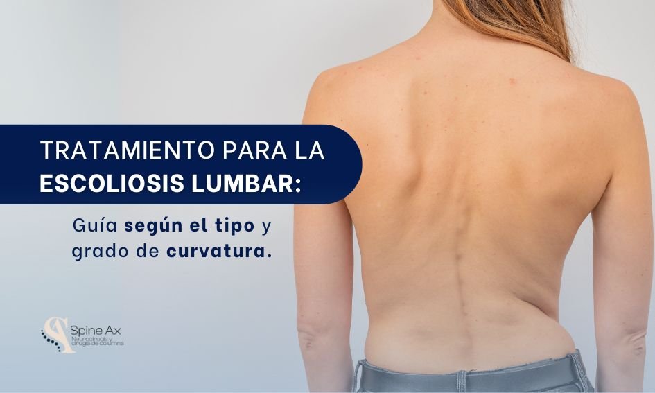 Tratamiento para la escoliosis lumbar en Bogotá - Spine AX