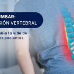 Tlif lumbar-SpineAX