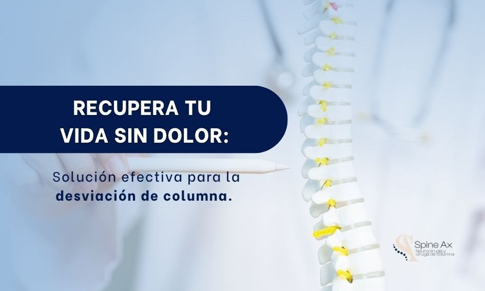Desviación de columna- SpineAx