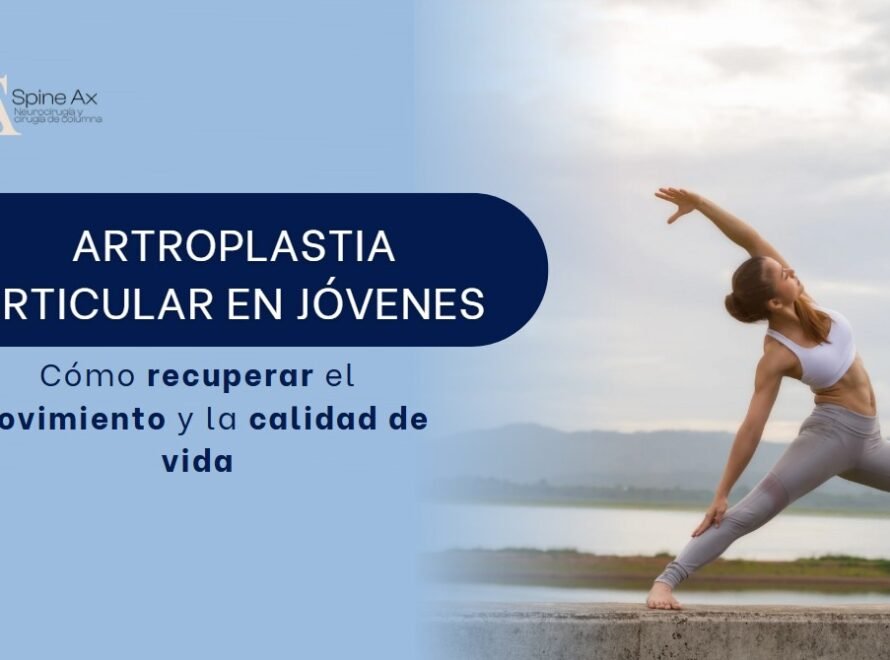 Artroplastia articular-SpineAx