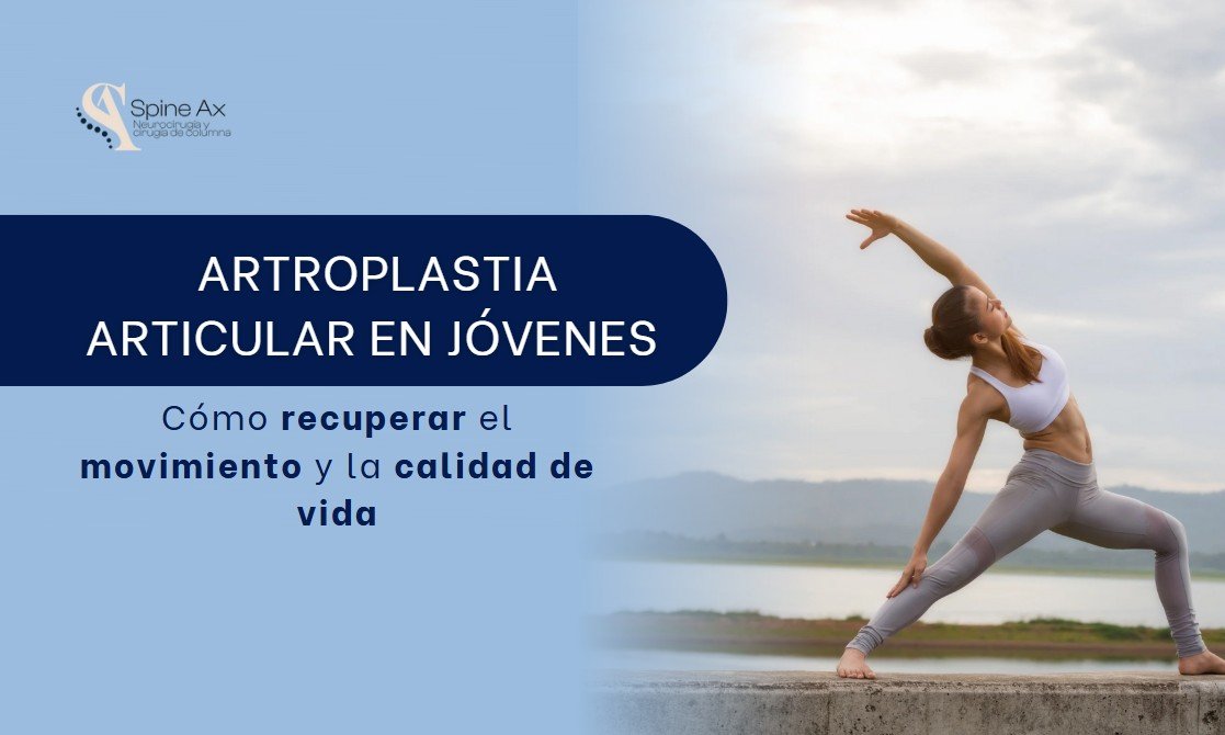 Artroplastia articular-SpineAx