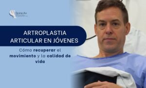 Artroplastia articular-SpineAx