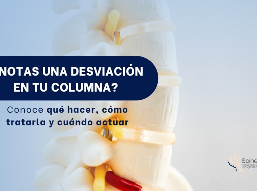 Desviación de columna-Spineax