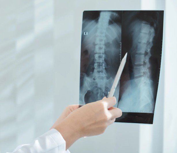 Exámenes previos a una cirugía de columna - Spine AX