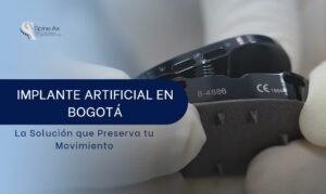 Implante artificial en Bogotá-SpineAx