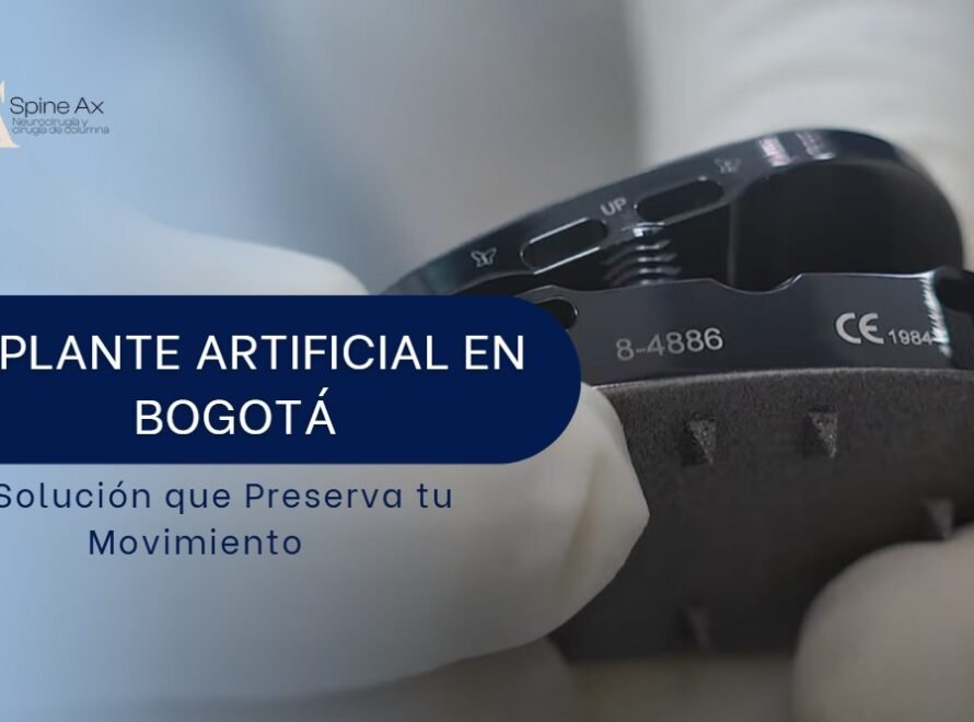 Implante artificial en Bogotá-SpineAx