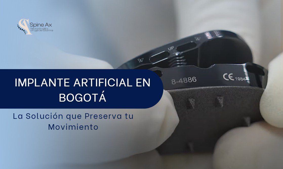 Implante artificial en Bogotá-SpineAx