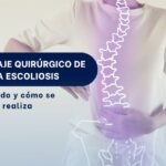 Cirugía de columna por escoliosis - Spine AX