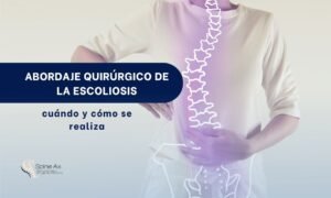 Cirugía de columna por escoliosis - Spine AX