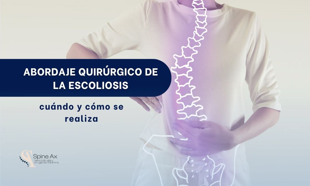 Cirugía de columna por escoliosis - Spine AX