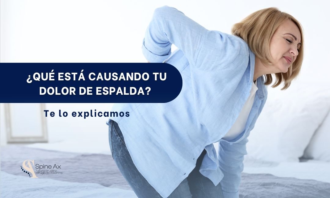 Cuáles son las causas del dolor de espalda - Spine AX - tratamientos de columna en Bogotá