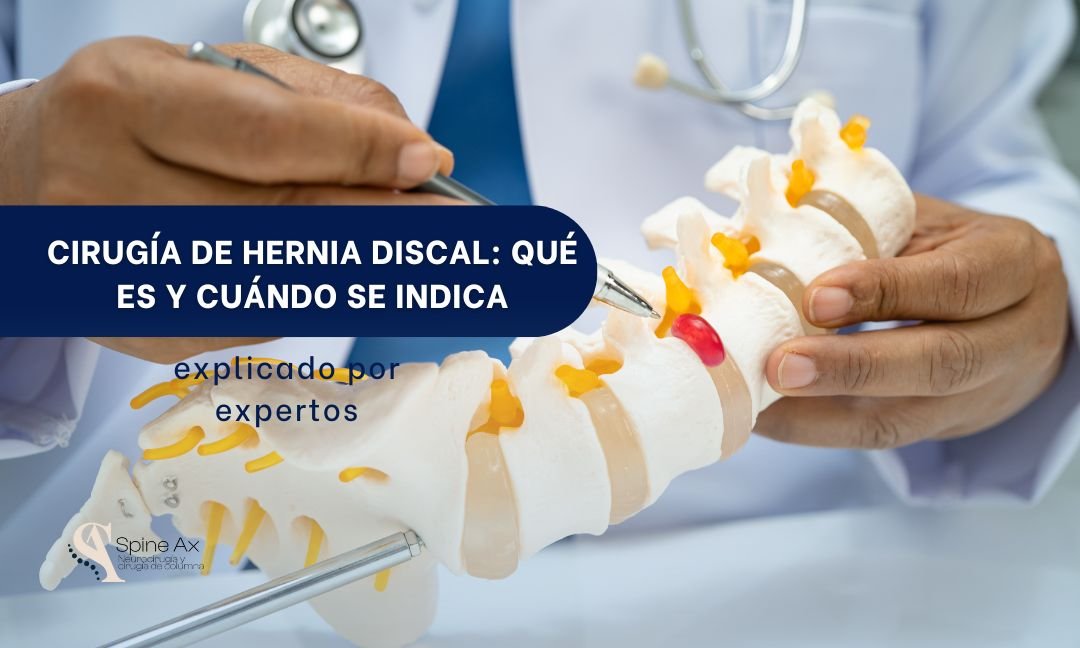 cirugía de hernia discal en Bogotá - Spine AX