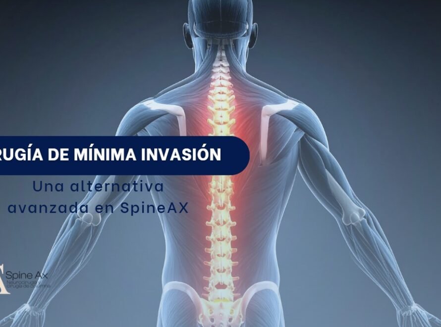 Cirugía de minima invasión-SpineAx