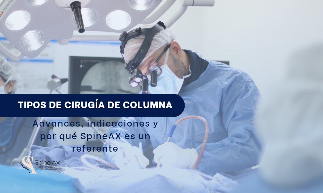 Tipos de cirugía de columna- SpineAx