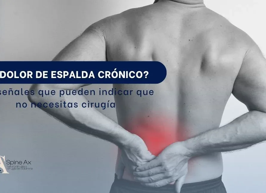 Dolor de espalda crónico Las señales que pueden indicar que no necesitas cirugía SPINEAX