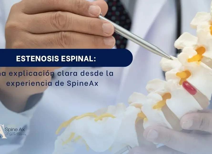 ESTENOSIS - SPINEAX BOGOTÁ