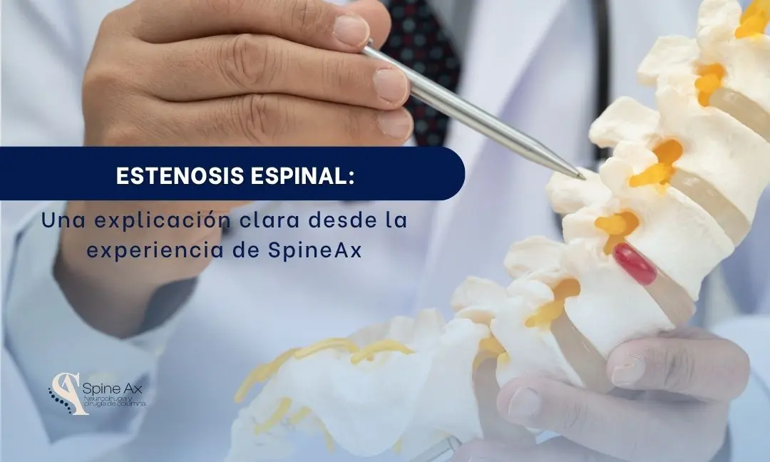 ESTENOSIS - SPINEAX BOGOTÁ