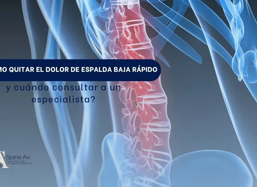 Cómo quitar el dolor de espalda baja rápido y cuándo consultar a un especialista - SPINEAX