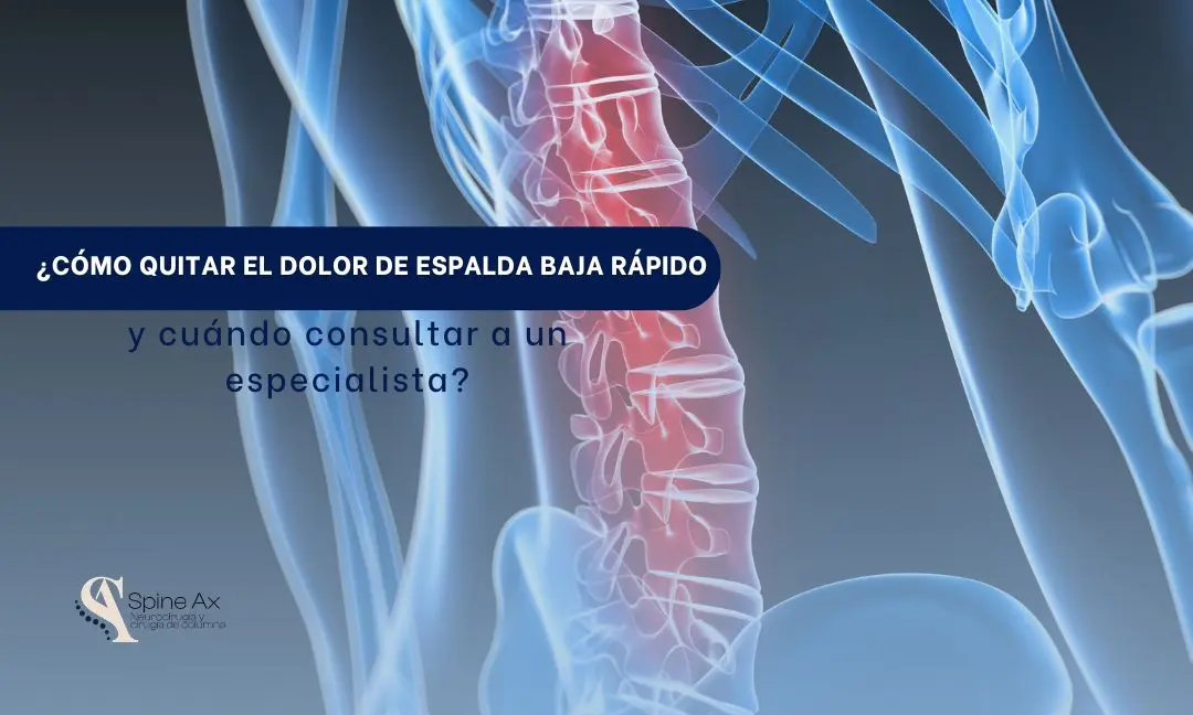 Cómo quitar el dolor de espalda baja rápido y cuándo consultar a un especialista - SPINEAX