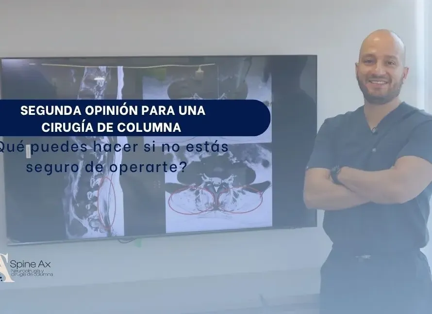 Segunda opinión para una cirugía de columna Qué puedes hacer si no estás seguro de operarte - Spineax