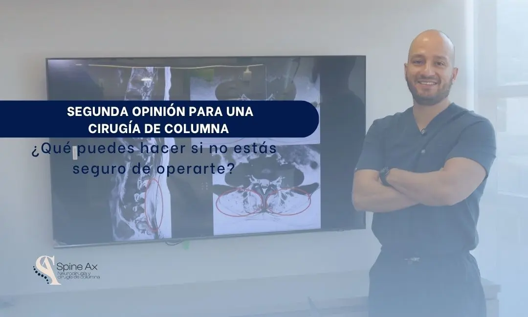 Segunda opinión para una cirugía de columna Qué puedes hacer si no estás seguro de operarte - Spineax