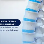 Artrodesis de la región lumbar- SpineAx Bogotá- Escialistas en columna