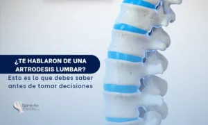Artrodesis de la región lumbar- SpineAx Bogotá- Escialistas en columna