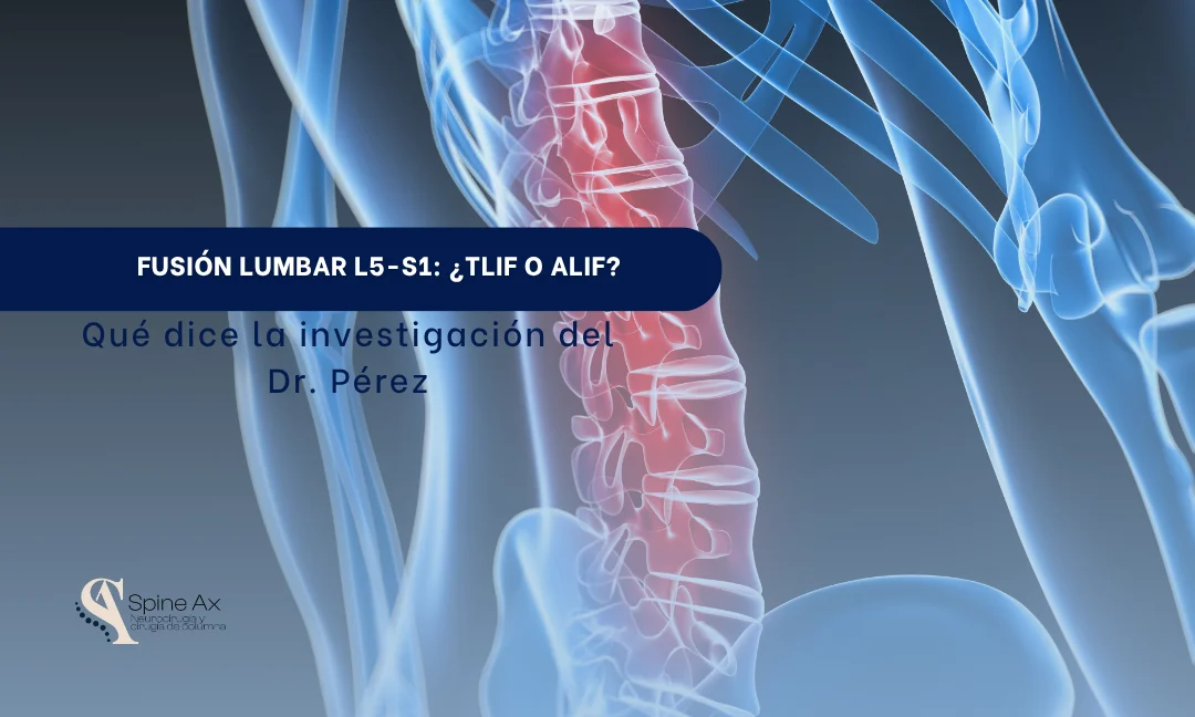 Radiografía de columna lumbar con el segmento L5-S1 resaltado, portada del artículo sobre fusión lumbar TLIF o ALIF del Dr. Pérez en SpineAx
