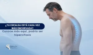 Hipercifosis- SpineAx en Bogotá