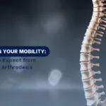 Spineal arthrodesis- SpineAx Bogotá