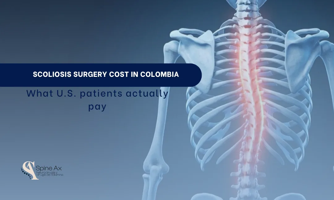 Scoliosis surgery cost in Colombia: spine with lateral scoliotic curve - SpineAx, Dr. Juan Carlos Perez, Bogota