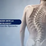 Qué hacer ante la cifoescoliosis Guía médica de SpineAx - Spineax