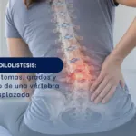 Espondilolistesis qué es, síntomas, grados y tratamiento de una vértebra desplazada - Spineax - Bogotá, Colombia