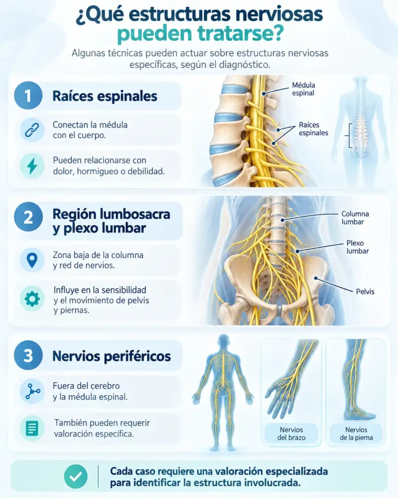 Estructuras nerviosas tratables por región neurólisis - Spineax