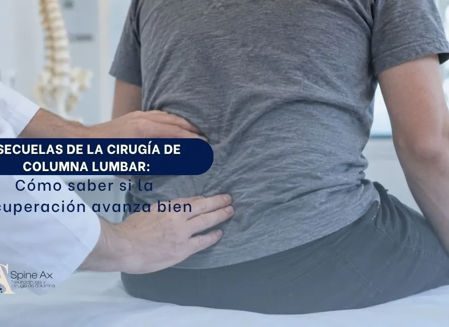 Secuelas de cirugía de columna lumbar Cómo saber si la recuperación avanza bien - Spineax